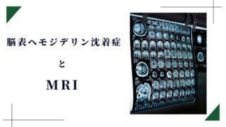 フィルムに印刷されたMRI画像